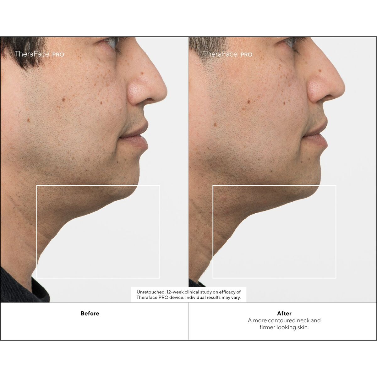 V6H291F3FAB679EF6B613818051630FEC45R4939055P8