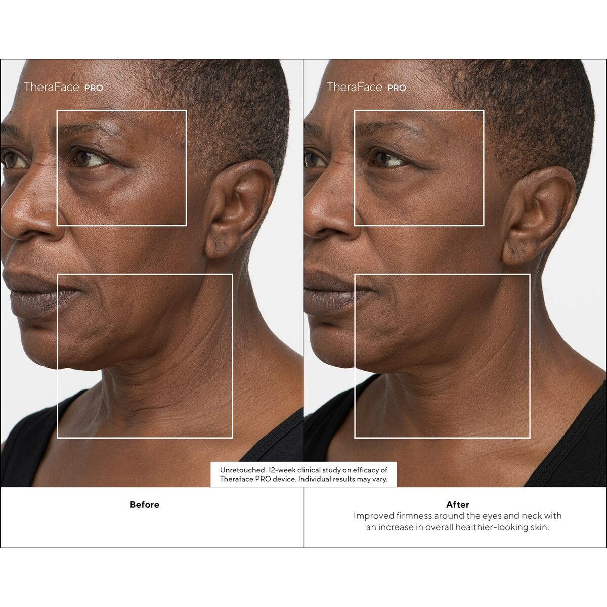 V6H24968A7E94E9DF67B31BD54103E15105R4939059P9